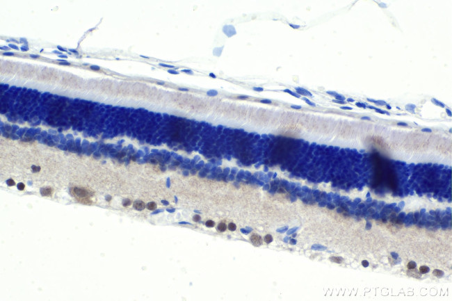 PRDM13 Antibody in Immunohistochemistry (Paraffin) (IHC (P))