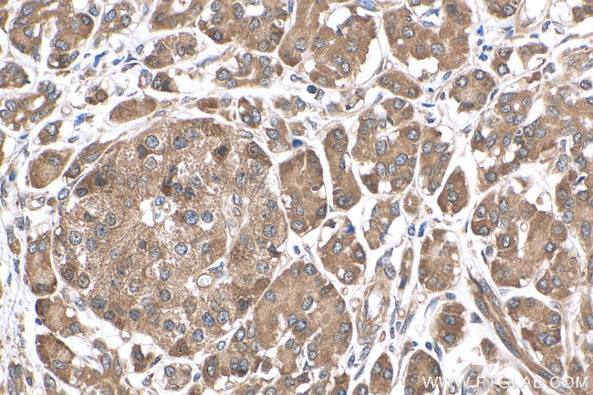 SLC16A13 Antibody in Immunohistochemistry (Paraffin) (IHC (P))