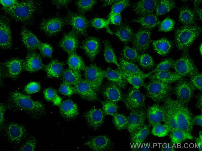 ANKIB1 Antibody in Immunocytochemistry (ICC/IF)