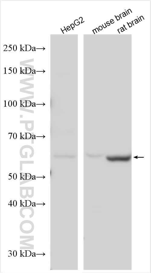 MTMR9 Antibody in Western Blot (WB)