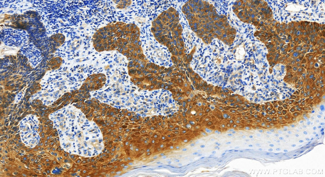 GSDMC Antibody in Immunohistochemistry (Paraffin) (IHC (P))