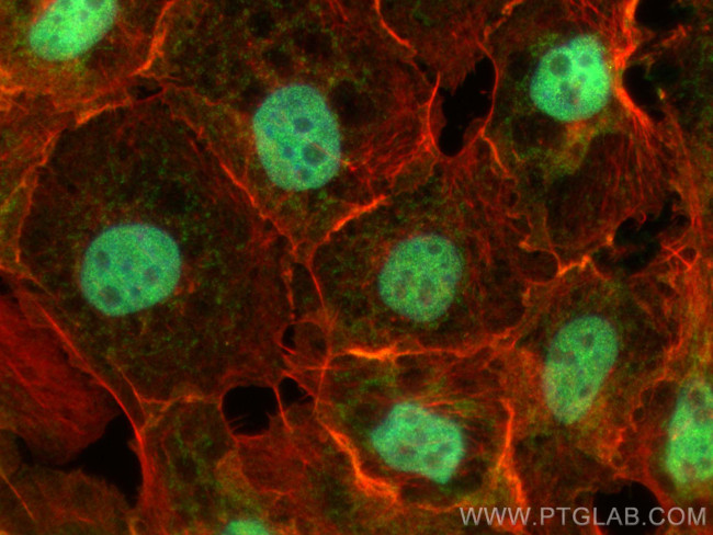 TOX2 Antibody in Immunocytochemistry (ICC/IF)