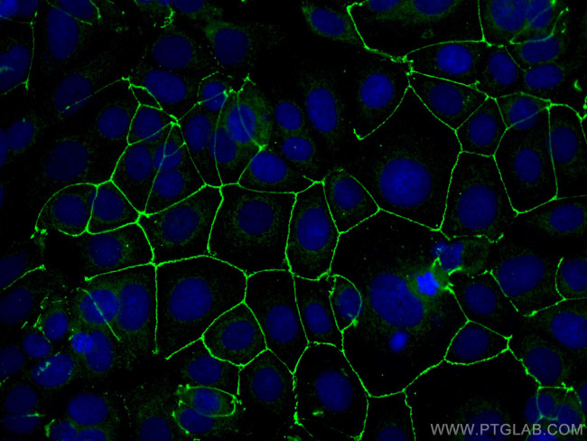ZO-1 Antibody in Immunocytochemistry (ICC/IF)