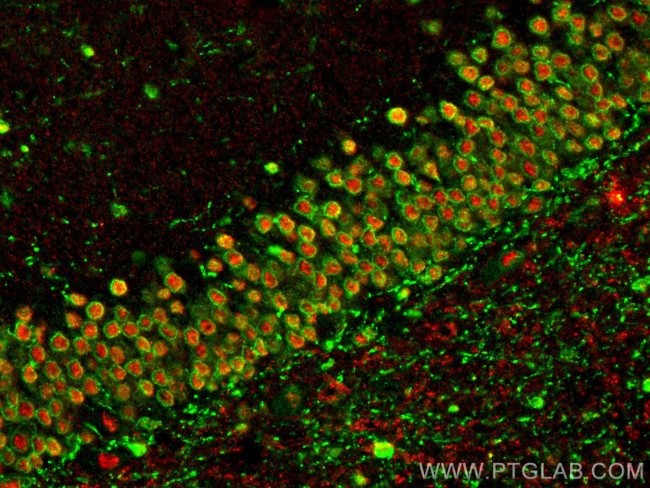 NRXN2 Antibody in Immunohistochemistry (PFA fixed) (IHC (PFA))