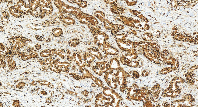 COPS3 Antibody in Immunohistochemistry (Paraffin) (IHC (P))