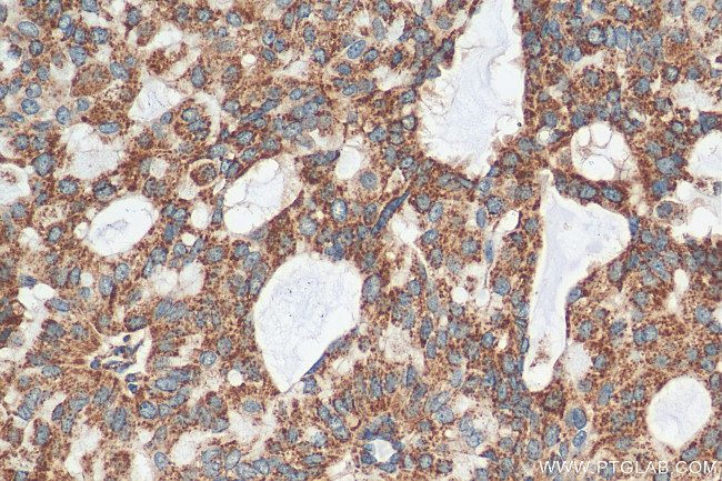 CSN2 Antibody in Immunohistochemistry (Paraffin) (IHC (P))