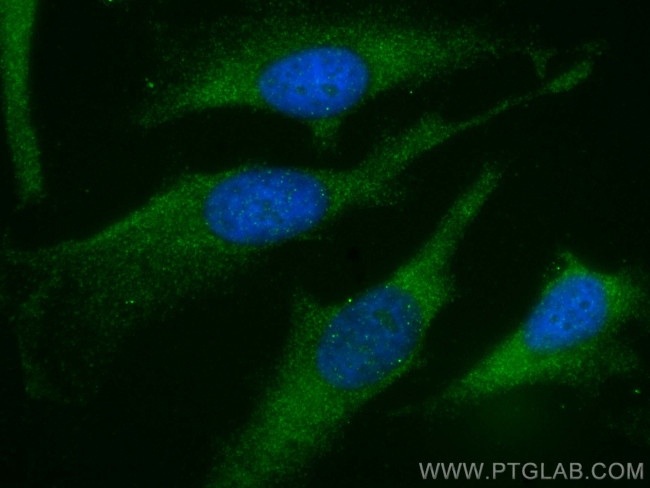 TAPBP Antibody in Immunocytochemistry (ICC/IF)