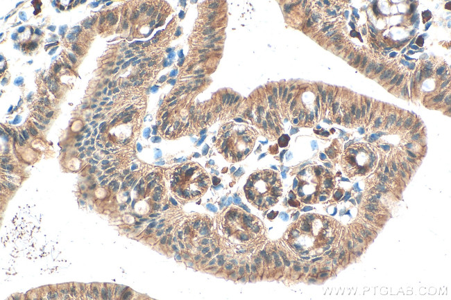 ARHGEF11 Antibody in Immunohistochemistry (Paraffin) (IHC (P))
