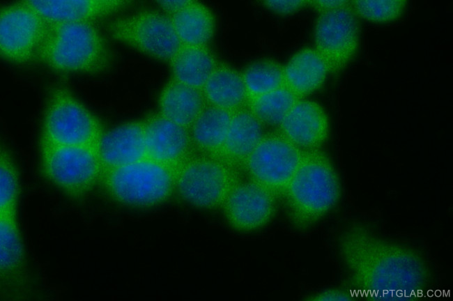 SEC23B Antibody in Immunocytochemistry (ICC/IF)