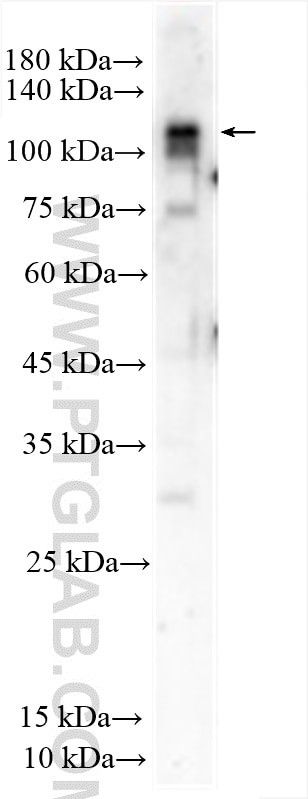 SNX29 Antibody in Western Blot (WB)