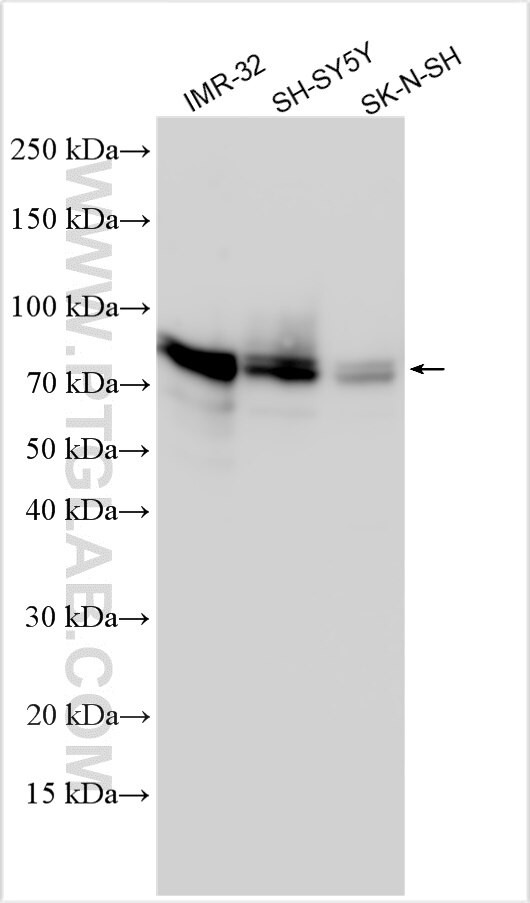 AK6 Antibody in Western Blot (WB)