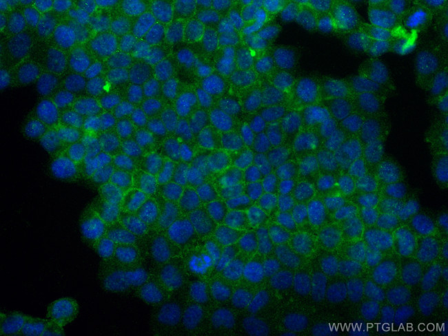 Claudin 9 Antibody in Immunocytochemistry (ICC/IF)