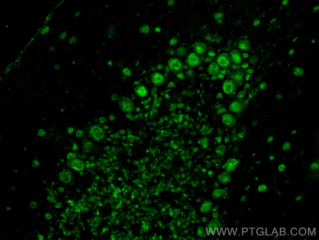 ACIN1-L Antibody in Immunohistochemistry (PFA fixed) (IHC (PFA))