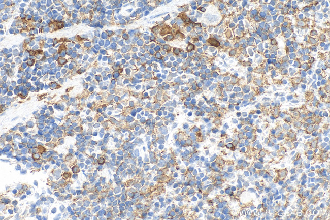 IBA1 Antibody in Immunohistochemistry (Paraffin) (IHC (P))