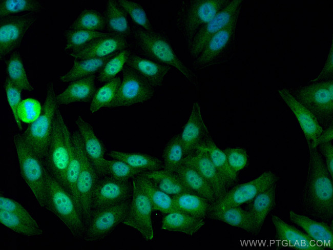 BANF1 Antibody in Immunocytochemistry (ICC/IF)