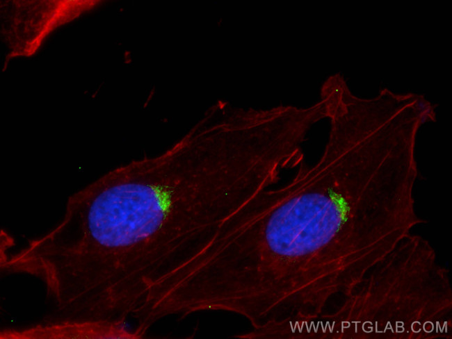 PI16 Antibody in Immunocytochemistry (ICC/IF)