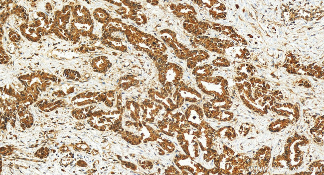 GSDMD Antibody in Immunohistochemistry (Paraffin) (IHC (P))