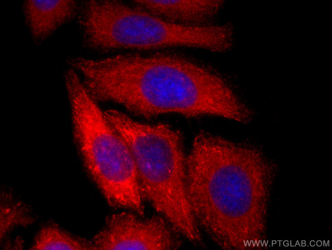 APOE Antibody in Immunocytochemistry (ICC/IF)