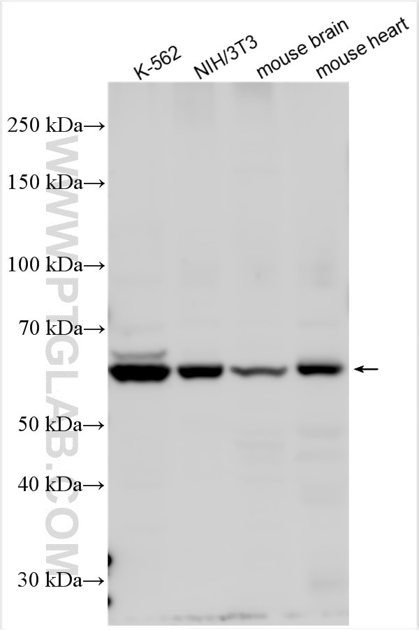 ALAS2 Antibody in Western Blot (WB)