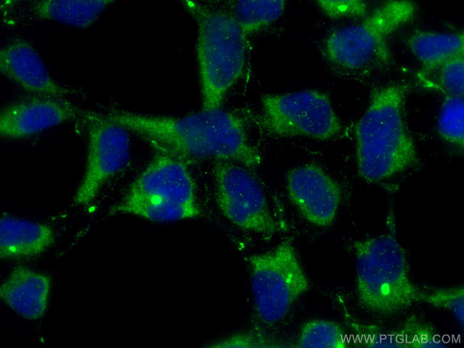 SIPA1L3 Antibody in Immunocytochemistry (ICC/IF)