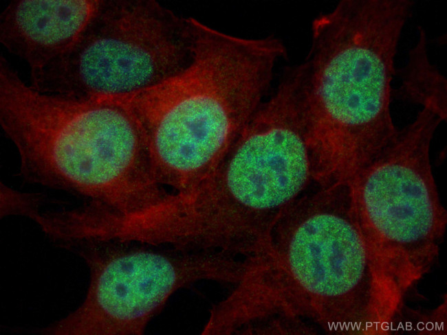 MTA1 Antibody in Immunocytochemistry (ICC/IF)