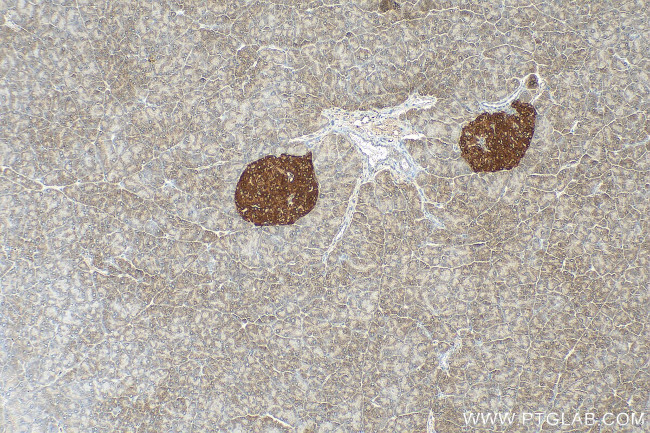 SYN1 Antibody in Immunohistochemistry (Paraffin) (IHC (P))