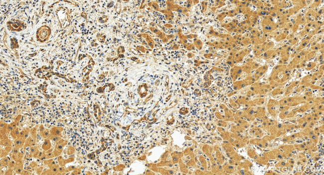 AKAP11 Antibody in Immunohistochemistry (Paraffin) (IHC (P))