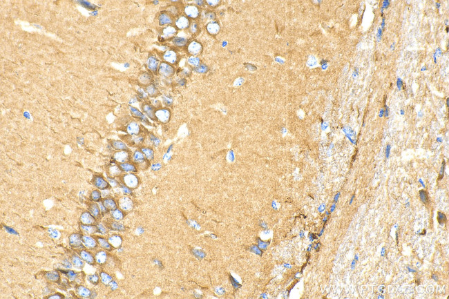 MFSD2 Antibody in Immunohistochemistry (Paraffin) (IHC (P))