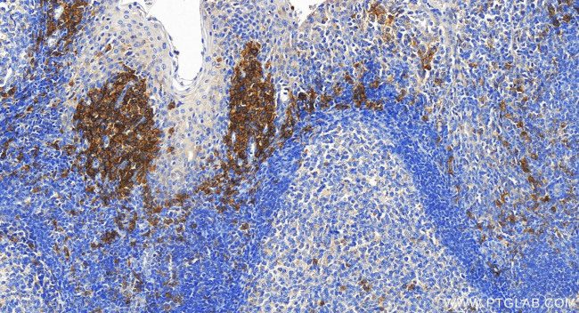 SLAMF7/CD319 Antibody in Immunohistochemistry (Paraffin) (IHC (P))