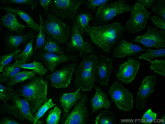 CD71 Antibody in Immunocytochemistry (ICC/IF)