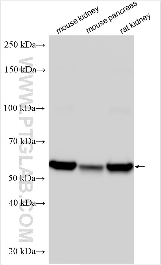 PM20D1 Antibody in Western Blot (WB)