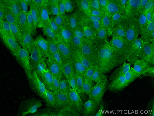 CFAP47 Antibody in Immunocytochemistry (ICC/IF)