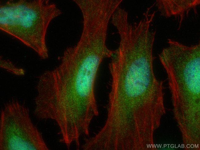 PSMA5 Antibody in Immunocytochemistry (ICC/IF)