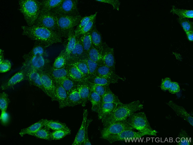 gp130/IL6ST Antibody in Immunocytochemistry (ICC/IF)