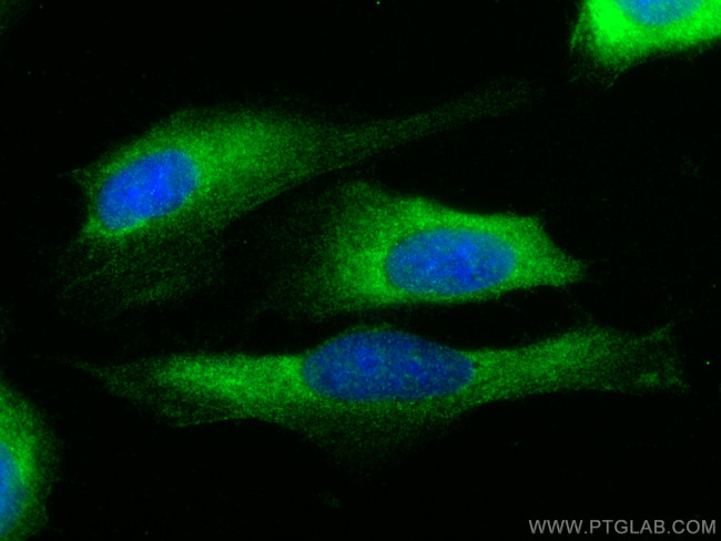 Mmp9 Antibody in Immunocytochemistry (ICC/IF)