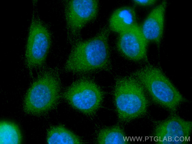 IGFBP3 Antibody in Immunocytochemistry (ICC/IF)