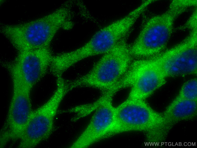VCAN Antibody in Immunocytochemistry (ICC/IF)
