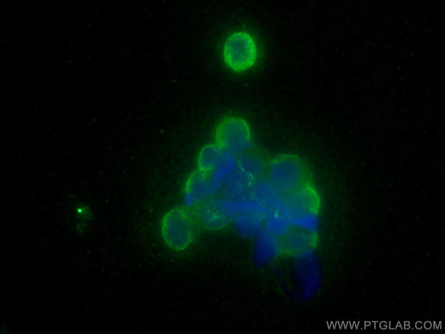 Fas/CD95 Antibody in Immunocytochemistry (ICC/IF)