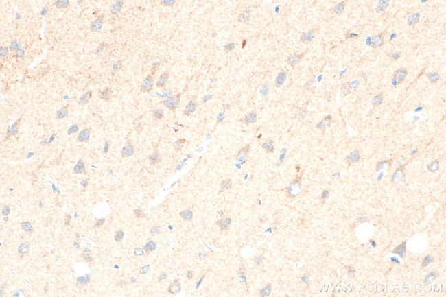 GHSR Antibody in Immunohistochemistry (Paraffin) (IHC (P))