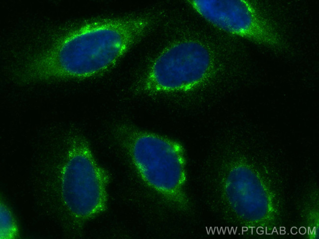 NUCB2/nesfatin-1 Antibody in Immunocytochemistry (ICC/IF)