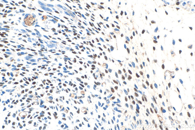 OSR1 Antibody in Immunohistochemistry (Paraffin) (IHC (P))