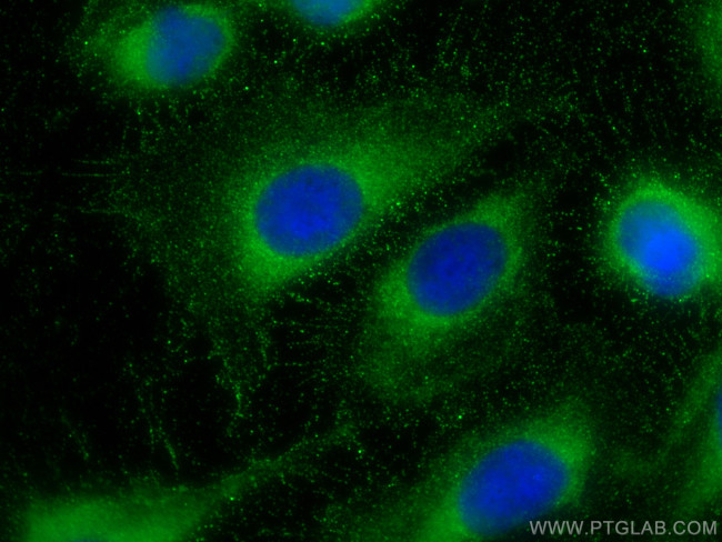 BMPR1A Antibody in Immunocytochemistry (ICC/IF)