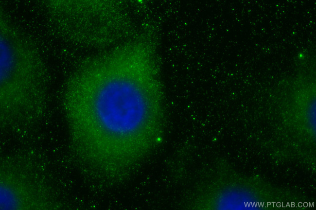 MMP11 Antibody in Immunocytochemistry (ICC/IF)