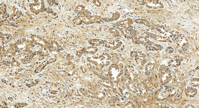 MLPH Antibody in Immunohistochemistry (Paraffin) (IHC (P))