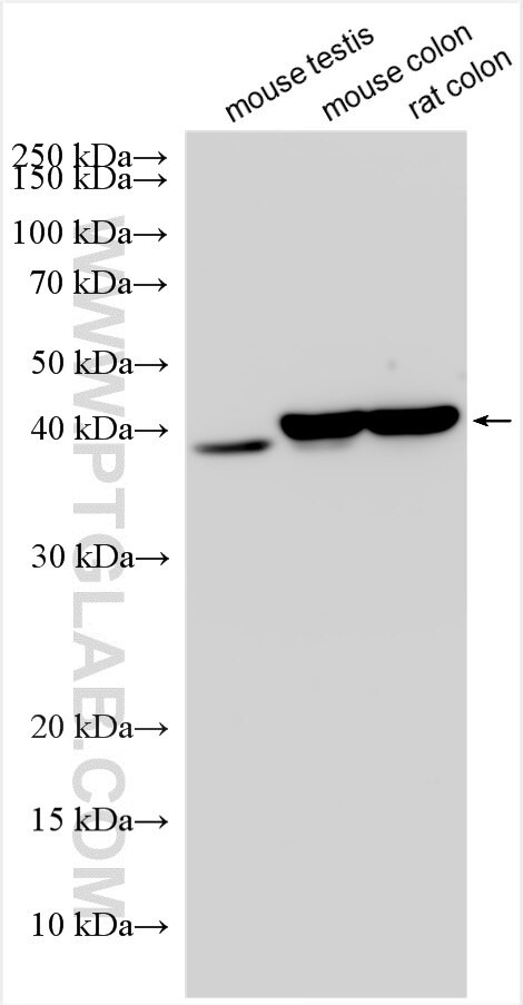 ADH1C Antibody in Western Blot (WB)