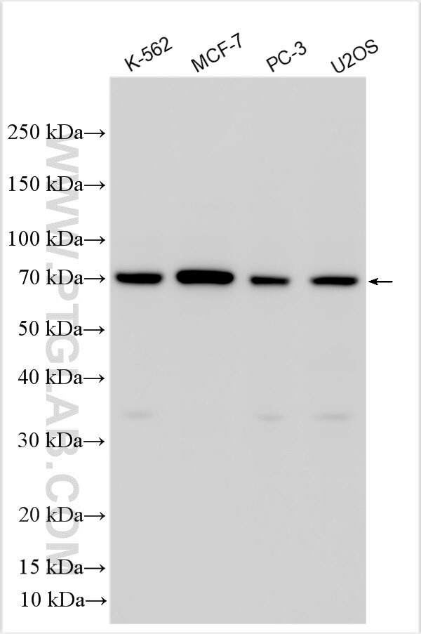 CACNA1B Antibody in Western Blot (WB)