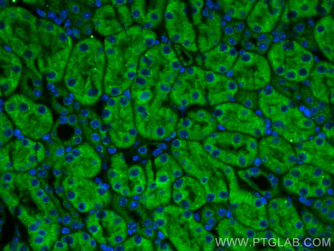 LAPTM4A Antibody in Immunohistochemistry (PFA fixed) (IHC (PFA))