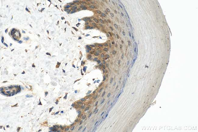 NOD2 Antibody in Immunohistochemistry (Paraffin) (IHC (P))