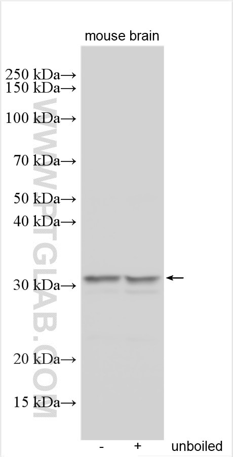 AMAC1 Antibody in Western Blot (WB)