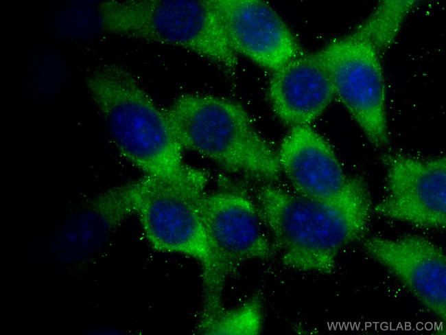 RAB8A Antibody in Immunocytochemistry (ICC/IF)